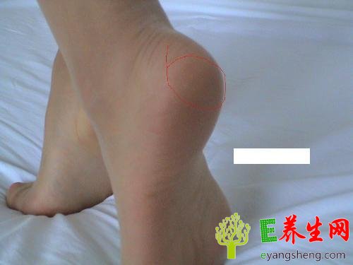 8个穴位治8种常见病 记住一生受益
